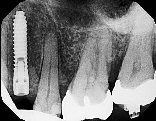 calgary dentist xray