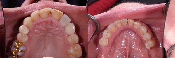 teeth examination after