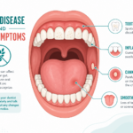 Illustration of 7 oral signs of celiac disease including tooth enamel defects and gum recession
