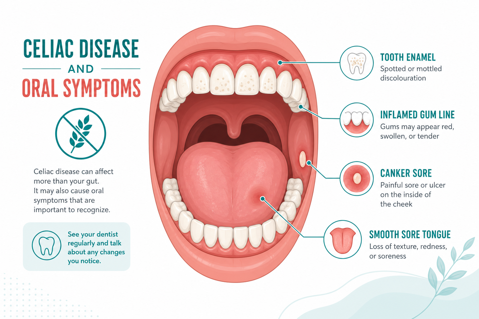 Illustration of 7 oral signs of celiac disease including tooth enamel defects and gum recession